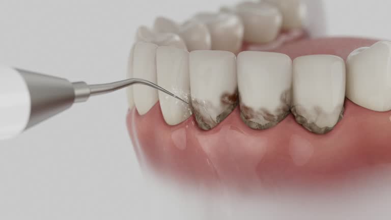 Trusted Teeth Cleaning And Checkup service in Frederickson, WA - Dentist Open Now